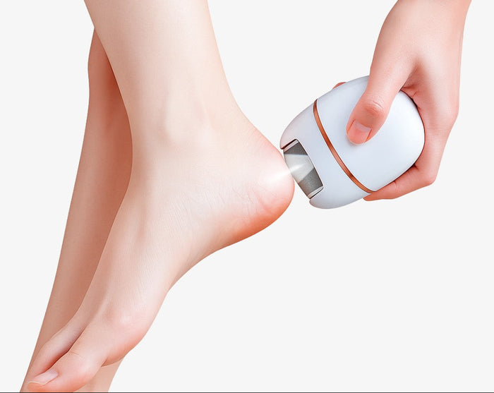 Elektryczny Pilnik do Stóp SmartCare™ – Urządzenie do Usuwania Zrogowaceń z Ergonomicznym Uchwyt 1